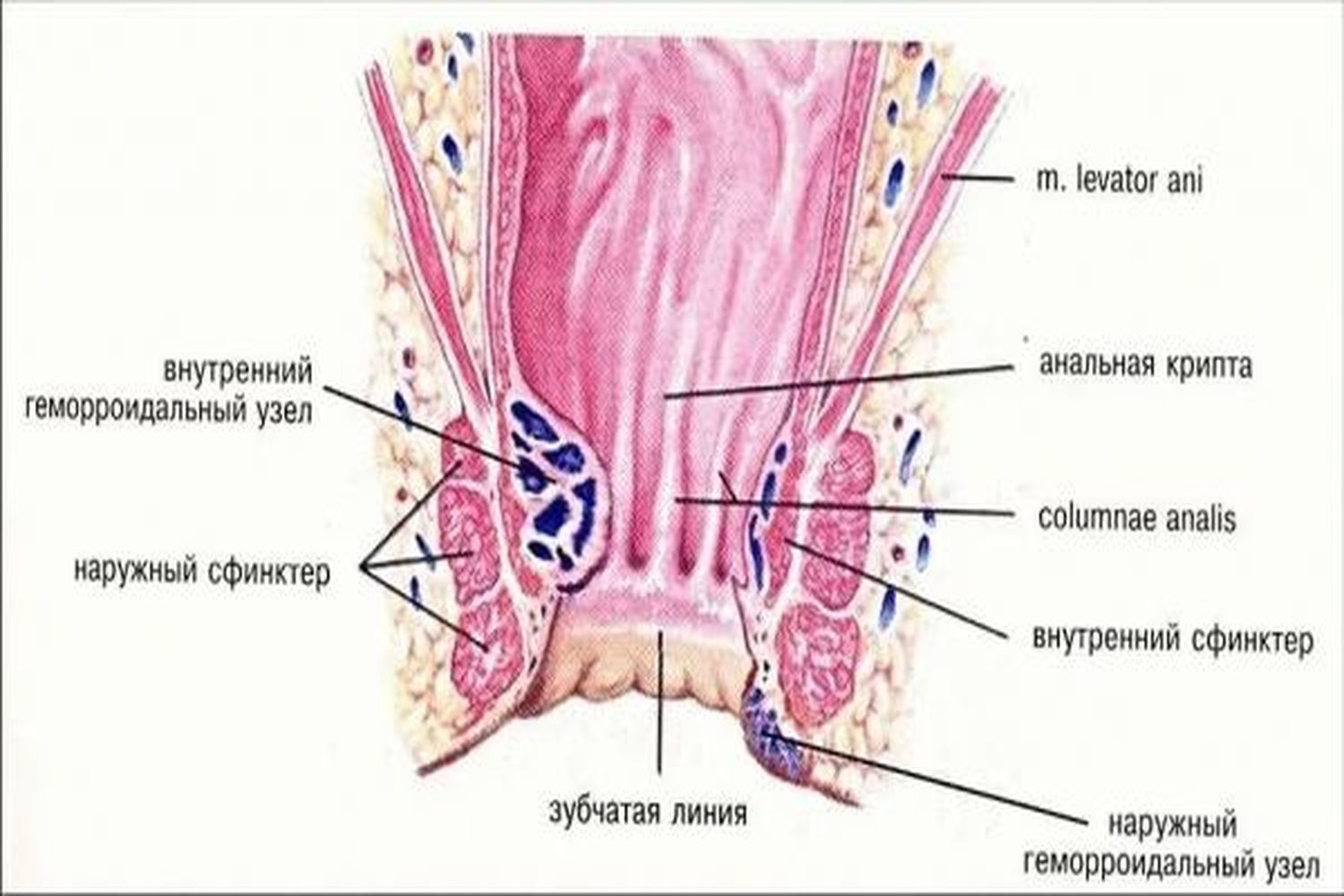 example